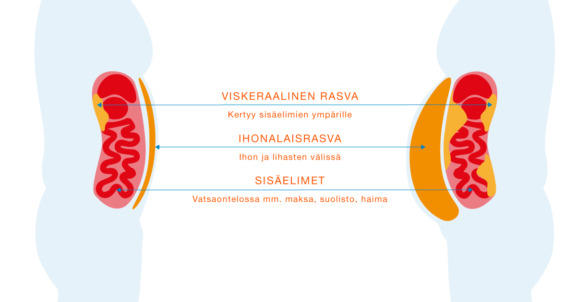 Infografiikka viskeraalisen rasvan ja ihonalaisrasvan kertymisen sijainneista. Viskeraalinen rasva kertyy vatsaonteloon sisäelimien ympärille ja ihonalaisrasva ihon ja lihasten väliin.